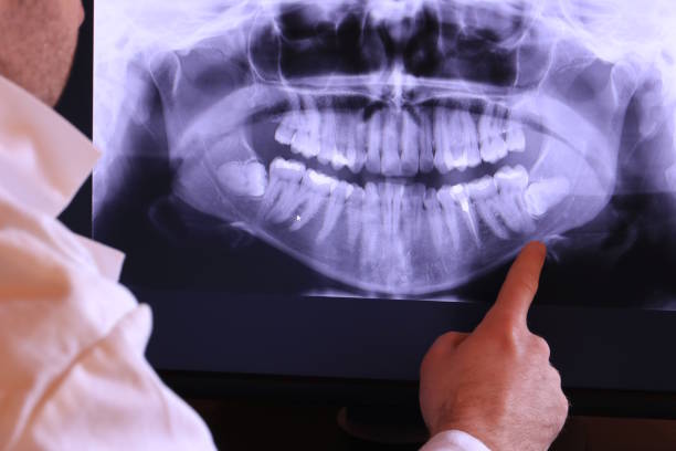 Best Emergency Dental Services for Seniors in Pearl Beach, MI