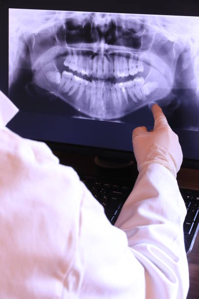 Best Holiday Emergency Dentist in Pearl Beach, MI