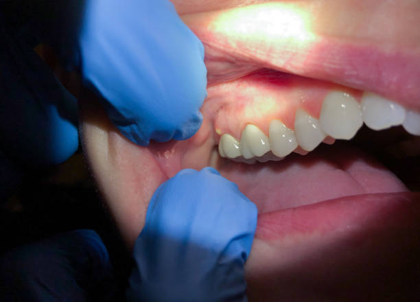 Best Orthodontic Emergency Dentist in Pearl Beach, MI