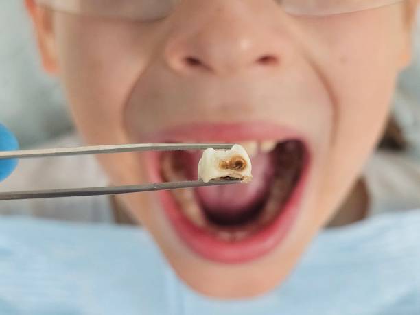 Best Emergency Dentist for Special Needs Patients in Pearl Beach, MI
